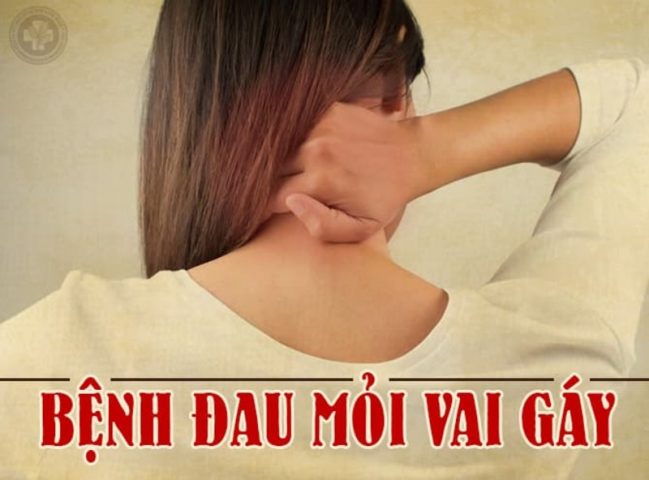 Bệnh đau mỏi vai gáy