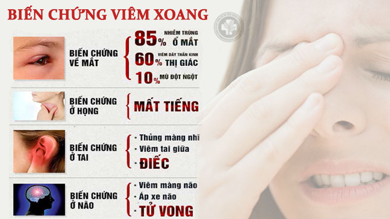 Viêm xoang gây nhiều biến chứng nguy hiểm, có thể đe dọa đến tính mạng