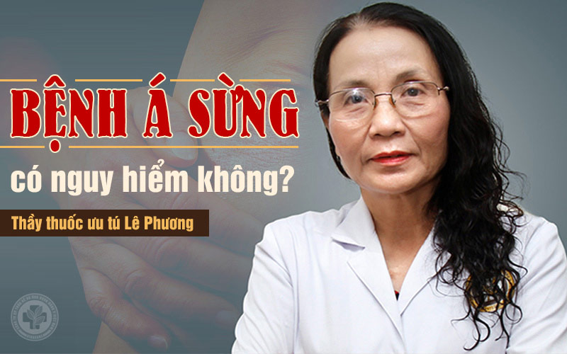 Bệnh á sừng có nguy hiểm không?