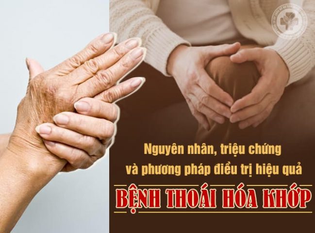 Bệnh thoái hóa khớp