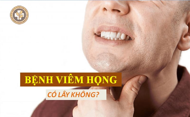 Bệnh viêm họng có lây không?