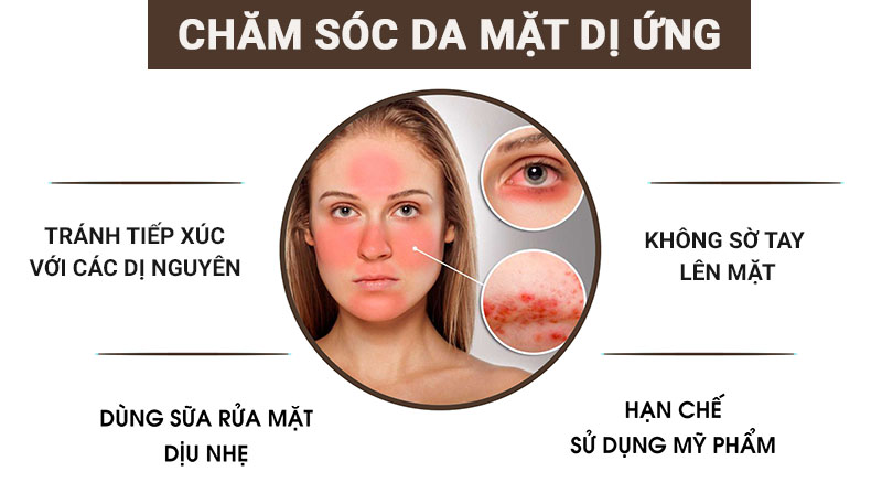 Một số lưu ý khi chăm sóc vùng da bị dị ứng