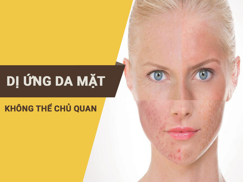 Dị ứng da mặt - Không thể chủ quan