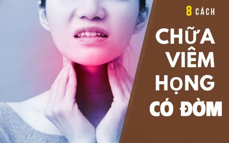 Chữa viêm họng có đờm