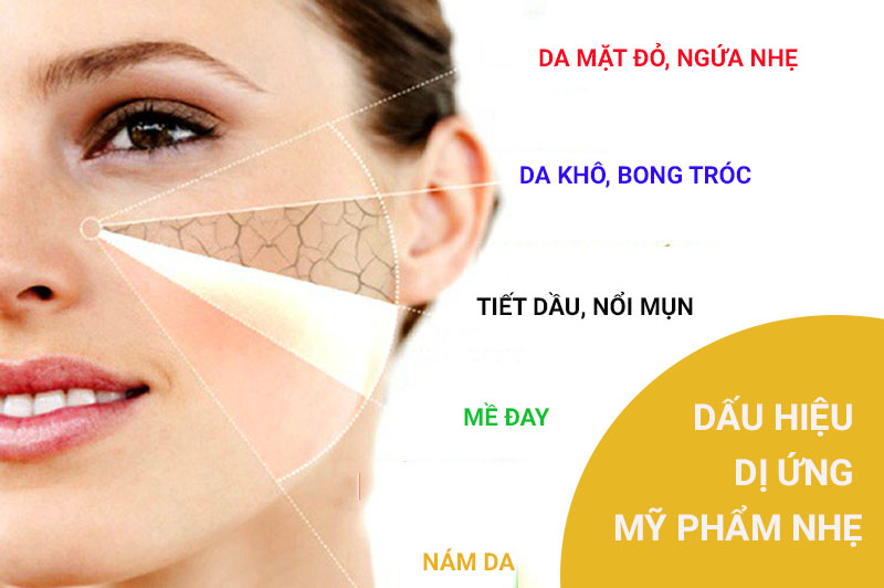 Dấu hiệu để nhận biết dị ứng mỹ phẩm nhẹ