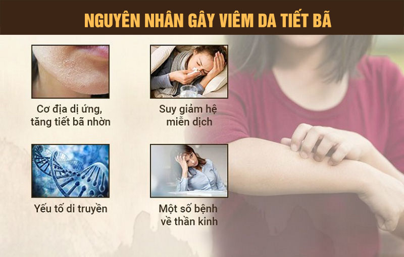 Một số yếu tố làm gia tăng nguy cơ khởi phát viêm da tiết bã