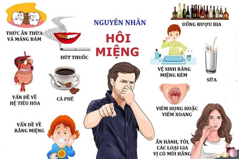 Có nhiều nguyên nhân gây viêm họng mủ 