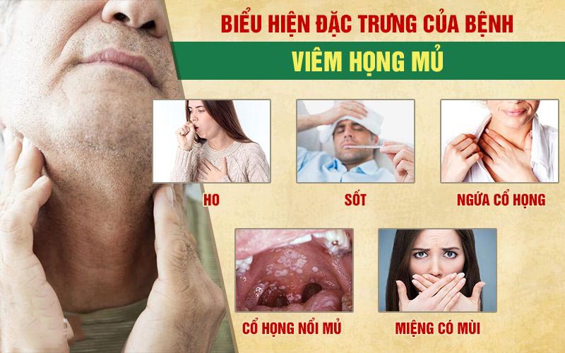 Bệnh có nhiều triệu chứng điển hình