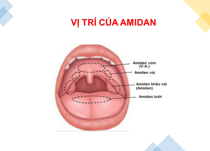 Vị trí của amidan