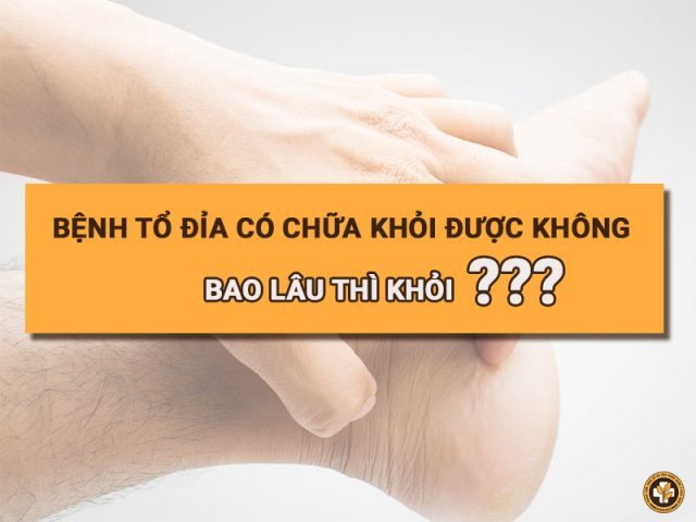 Bệnh tổ đỉa có chữa được không