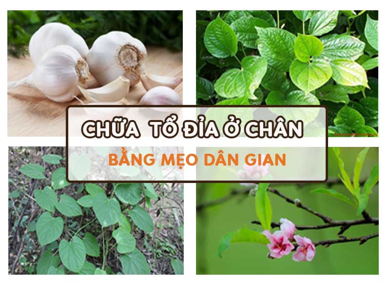 Tổ đỉa có thể được chữa bằng những nguyên liệu dân gian tại nhà