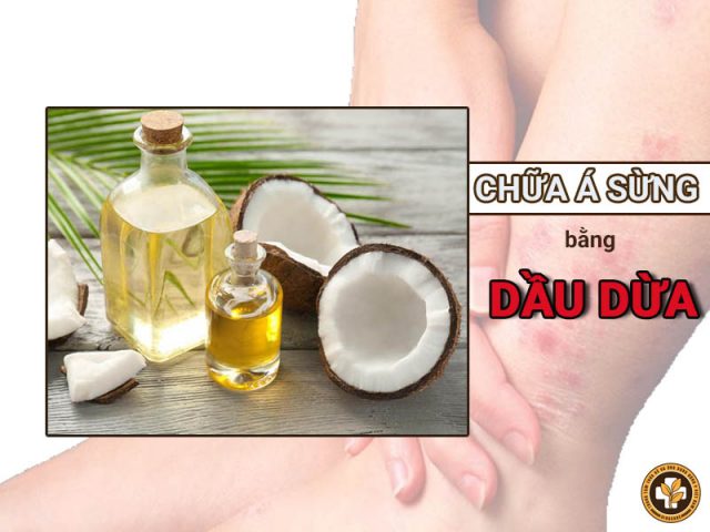 cách chữa bệnh á sừng bằng dầu dừa