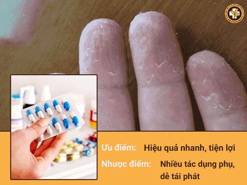 Thuốc tân dược gây nhiều tác dụng phụ, ảnh hưởng đến sức khỏe