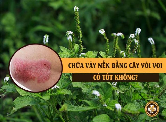 Cây vòi voi chữa vảy nến