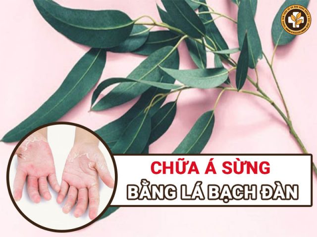 Chữa á sừng bằng lá bạch đàn