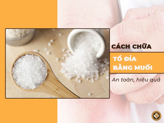 Chữa bệnh tổ đỉa bằng muối