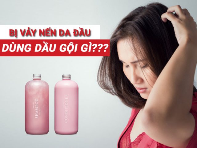 Dầu gội trị vảy nến da đầu