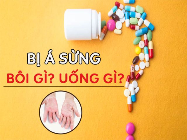 Thuốc chữa bệnh á sừng