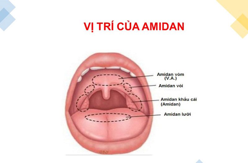 Vị trí của amidan