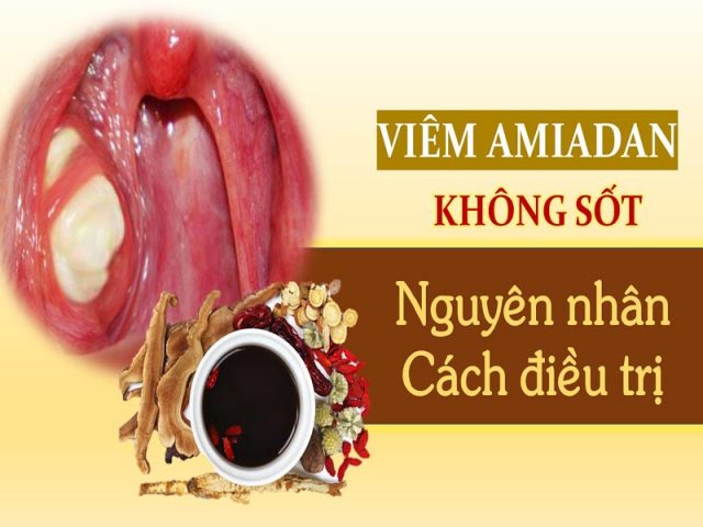 Viêm amidan không sốt