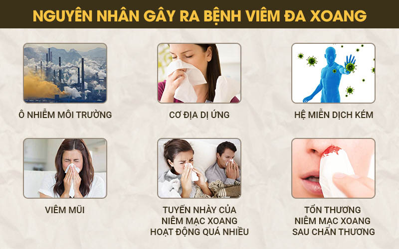 Có nhiều nguyên nhân gây viêm đa xoang 