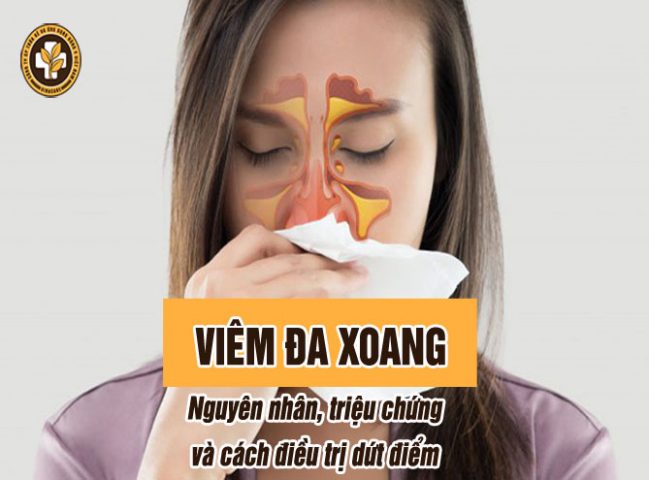 Viêm đa xoang