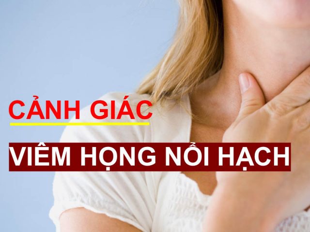 Viêm họng nổi hạch