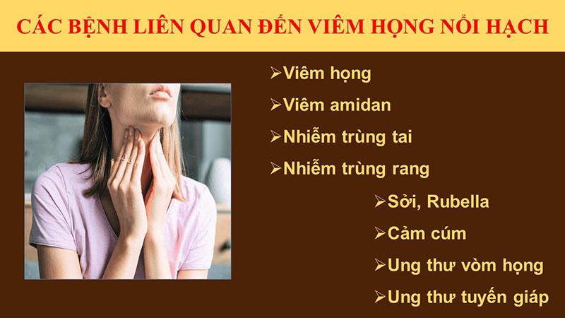 Viêm họng nổi hạch cảnh báo nhiều bệnh lý nguy hiểm