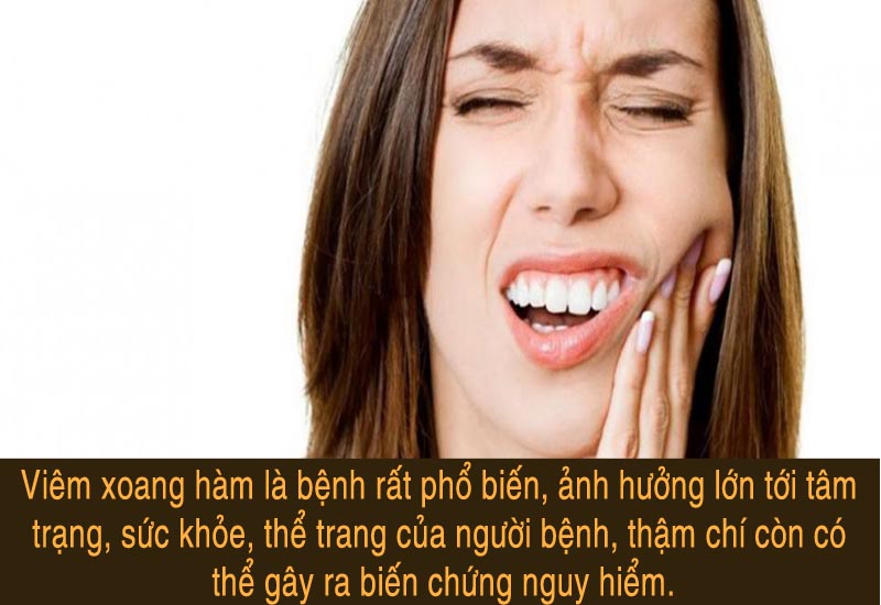 Viêm xoang hàm