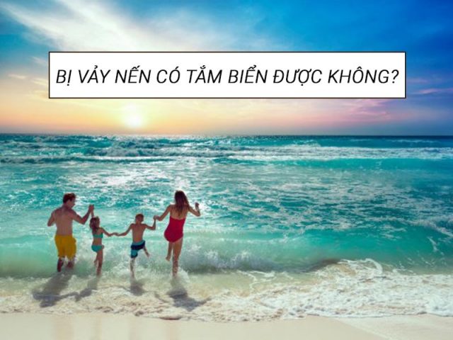 Bị vảy nến có tắm biển được không?