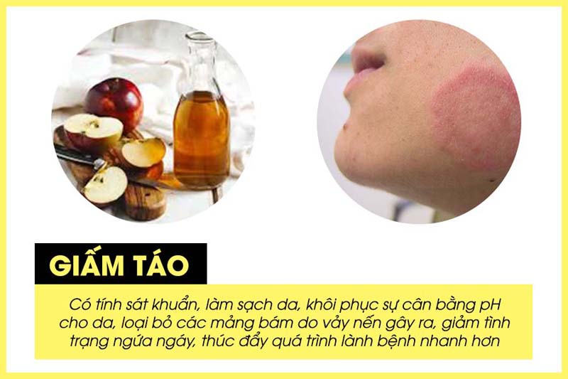 Giấm táo có nhiều tác dụng trong giảm triệu chứng bệnh