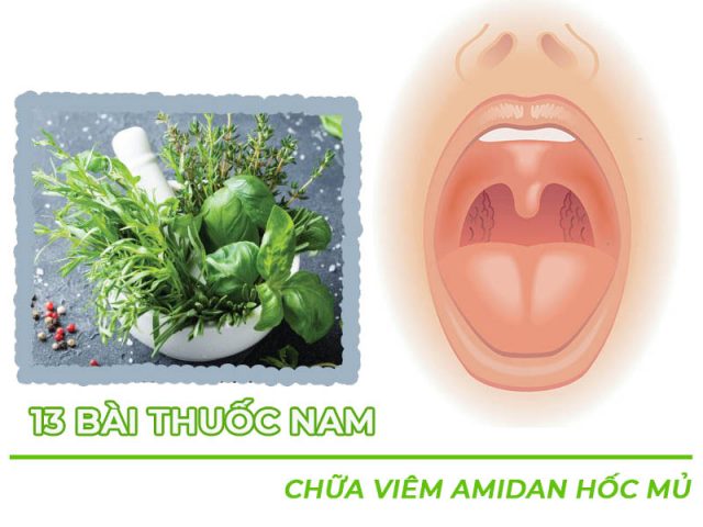 Các cách chữa viêm amidan hốc mủ bằng thuốc nam