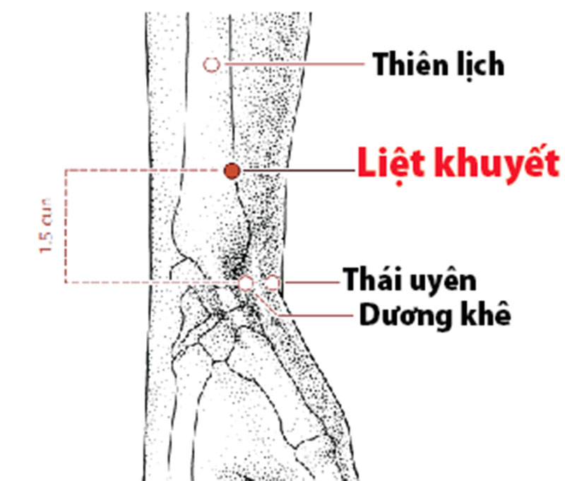 Huyệt Liệt Khuyết chữa viêm họng