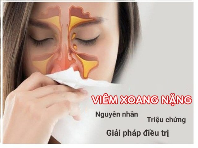 Viêm xoang nặng nguy hiểm, điều trị thế nào