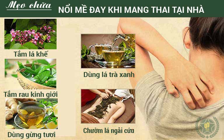 Chữa mổi mề đay khi mang thai bằng mẹo dân gian tại nhà