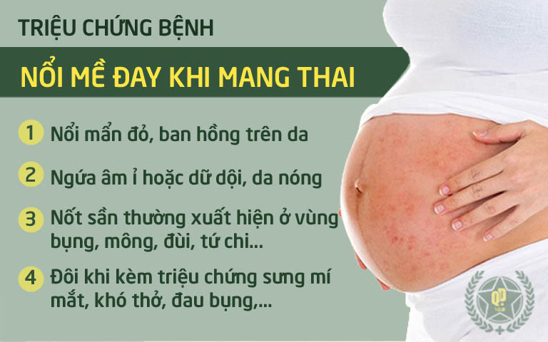 Triệu chứng nổi mề đay khi mang thai 