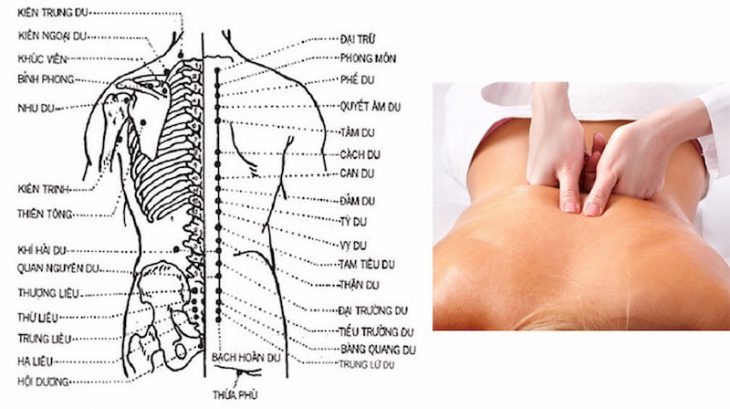 Bấm huyệt chữa thoát vị đĩa đệm có hiệu quả hay không?