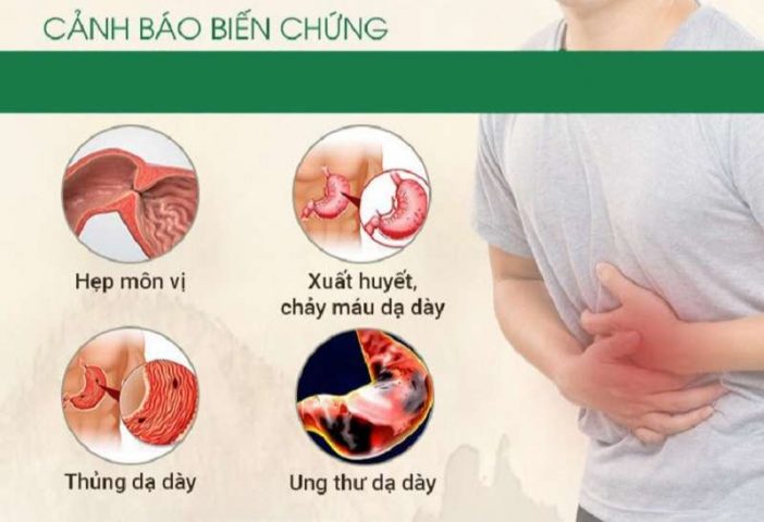 Các biến chứng bệnh dạ dày và cách phòng ngừa hiệu quả