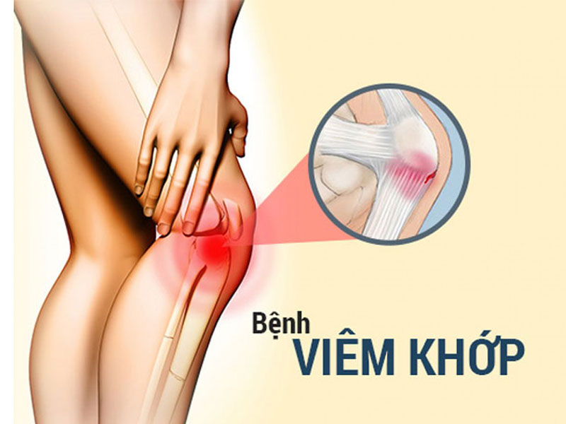 Đau khớp gối khi đứng lên ngồi xuống là bệnh lý viêm khớp dạng thấp