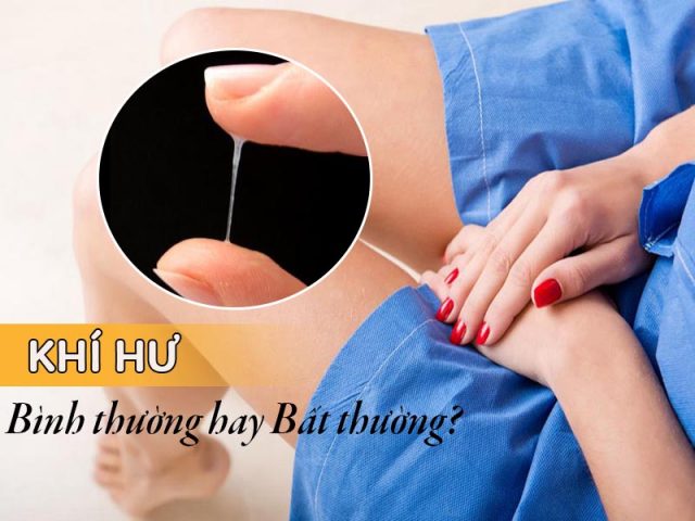 Khí hư là gì? Cách phân biệt khí hư bình thường, khí hư bất thường - Nguyên nhân triệu chứng kèm theo