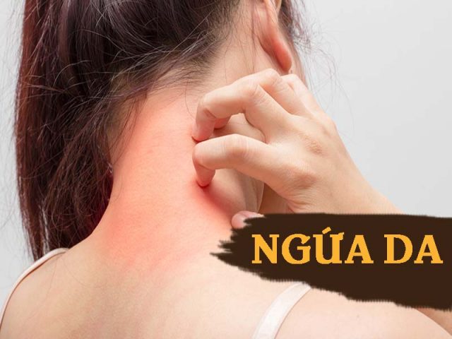 Ngứa da - Nguyên nhân, triệu chứng, cách điều trị và phòng bệnh [TỔNG HỢP]