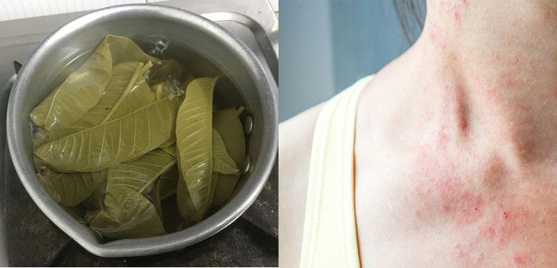 Những lưu ý khi dùng lá tắm chữa viêm da cơ địa