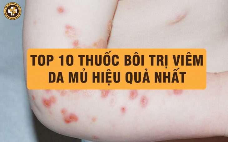 Thuốc bôi ngoài da trị viêm da mủ