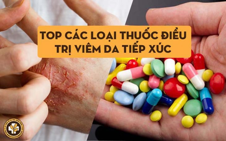 Các loại thuốc điều trị viêm da tiếp xúc hiện nay