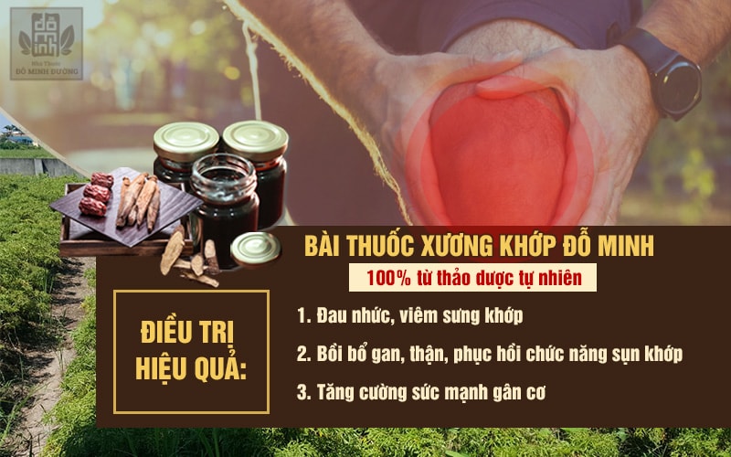 Phương thuốc điều trị viêm đau khớp 150 năm nhà thuốc Đỗ Minh Đường