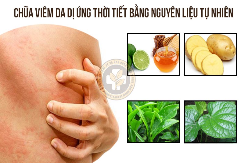 Điều trị bệnh bằng các nguyên liệu tự nhiên tại nhà