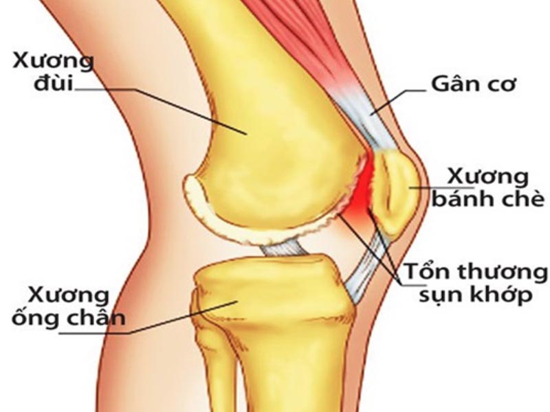 Khớp gối có vị trí quan trọng giúp chúng ta di chuyển dễ dàng