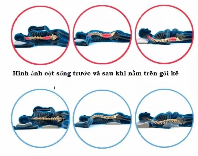 Tác dụng của gối kê hỗ trợ