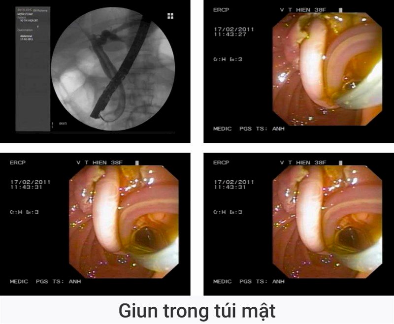 Kí sinh trùng là một trong những nguyên nhân quan trọng gây ra bệnh