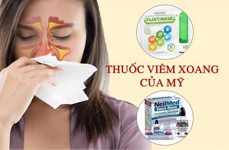 TOP 4 thuốc viêm xoang của Mỹ được nhiều người bệnh tin dùng nhất